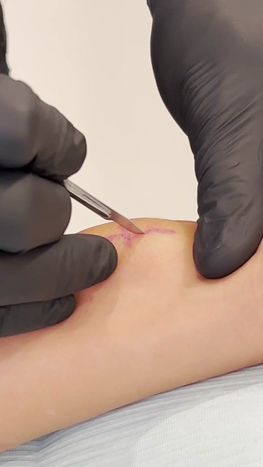 TikTok video thumbnail by dr_mudgil