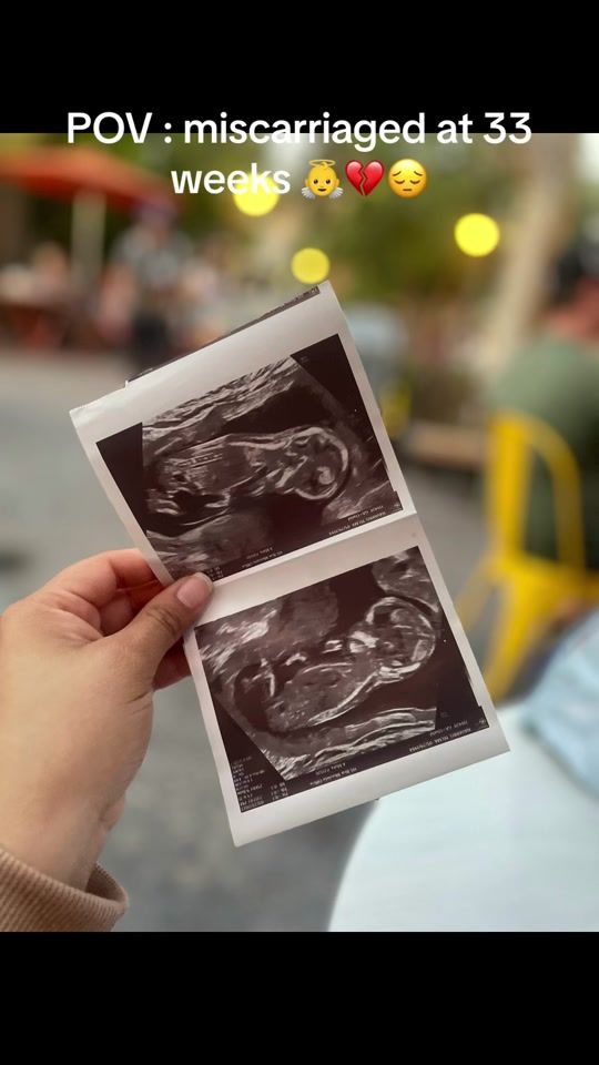 TikTok video thumbnail by telmanavarro5