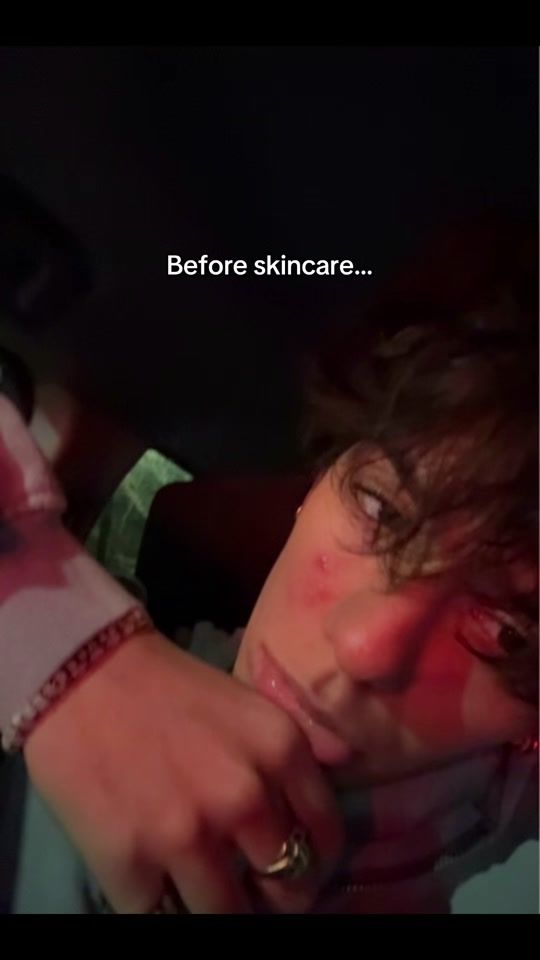 TikTok video thumbnail by notces4r